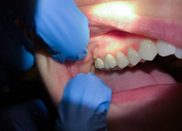 Best Emergency Orthodontic Repairs in Almedia, PA
